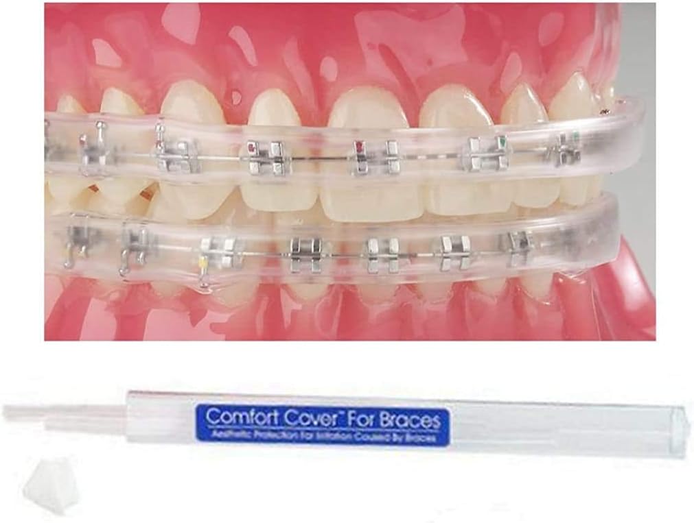 Comfort Lip Shield/Mouth Guard - For Braces - Orthodontic - Dental