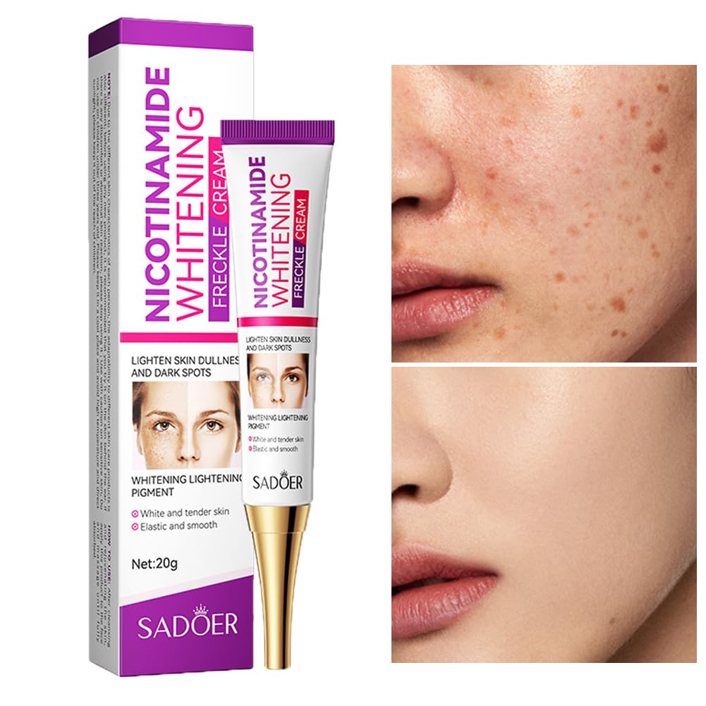 Dark Spot Remover for Face,Nicotinamide Whitening Freckle Cream,Skin Dullness Lightening Body Cream,Visible Results in 28 Days,Smooth Melasma,Hyperpigmentation Age Dark Spot Corrector,0.7 oz