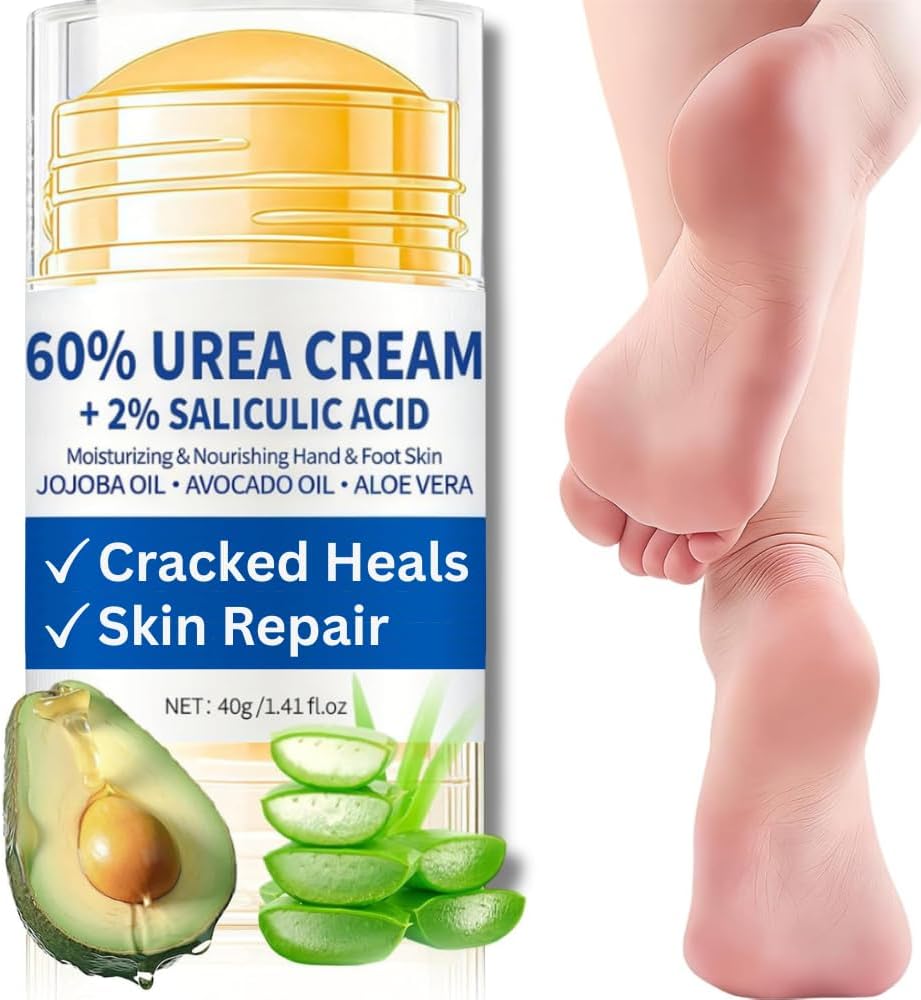 Urea Cream 60 Percent for Feet - Deeply Moisturizing Cracked Heel Repair Cream For Fast Relief - Urea Foot Cream - Foot Cream for Cracked Heels and Dry Skin - Foot Moisturiser - Skin Care Hands & Feet