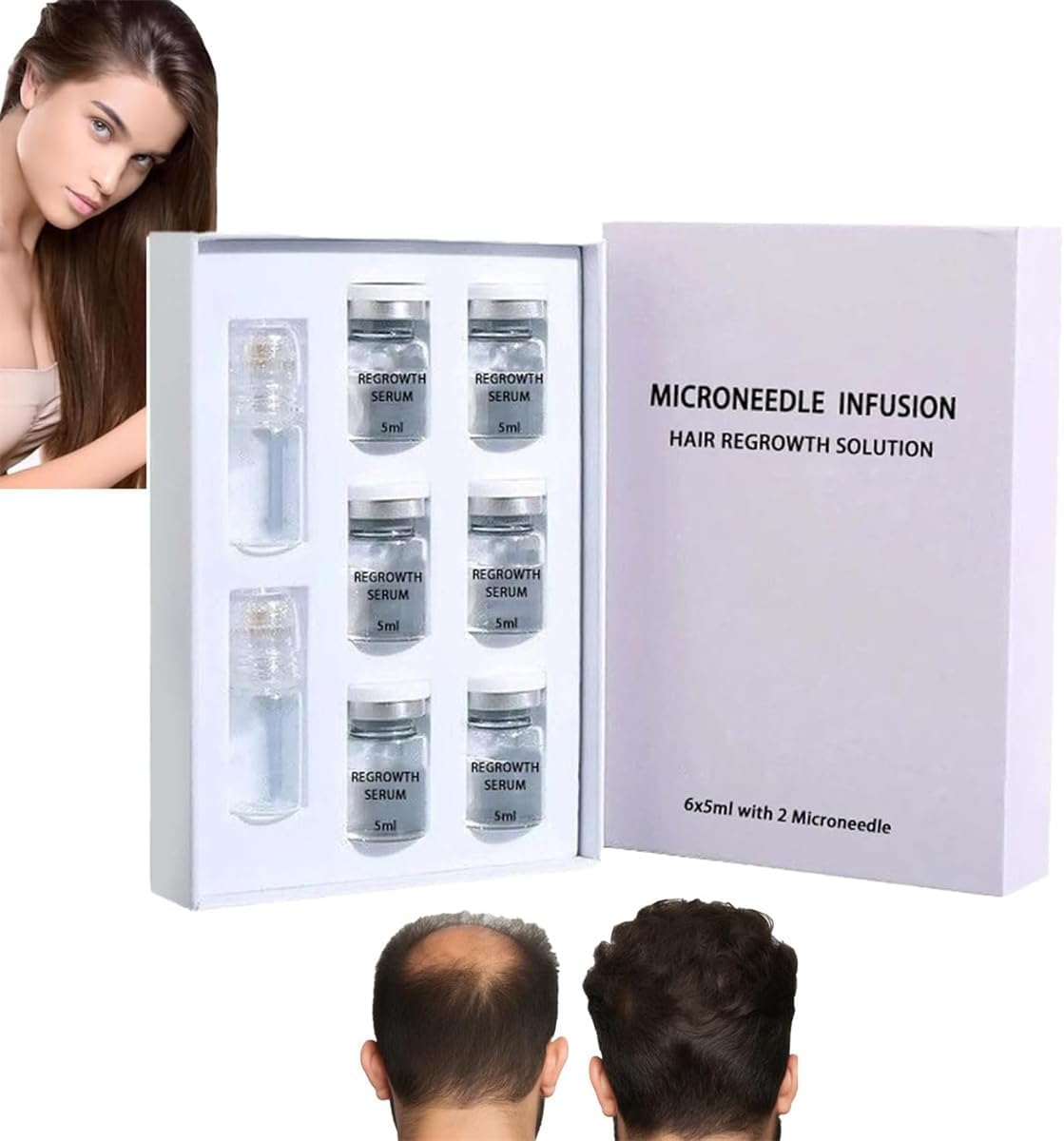 AlphaInfuse Hair Regrowth System - ALPHA INFUSE Microneedle Infusion Hair Regrowth Solution, Painless Micro-Infusion Technology for Hair Growth, Increases Serum Absorption by 300% (Set B)