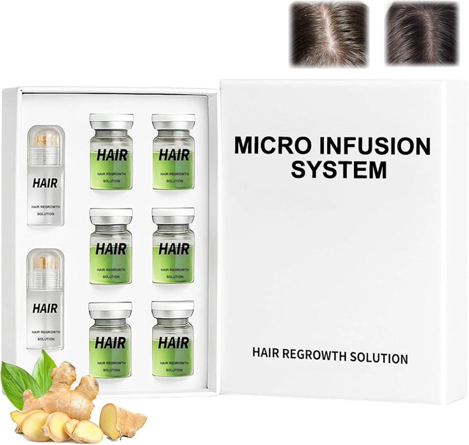 Alphainfuse Hair Regrowth System, Micro Infusion Hair Growth Kit with Peppermint Oil and Ginger Root, Hair Growth Care Strengthens Roots Make Hair Thicker and Healthier for Men Women