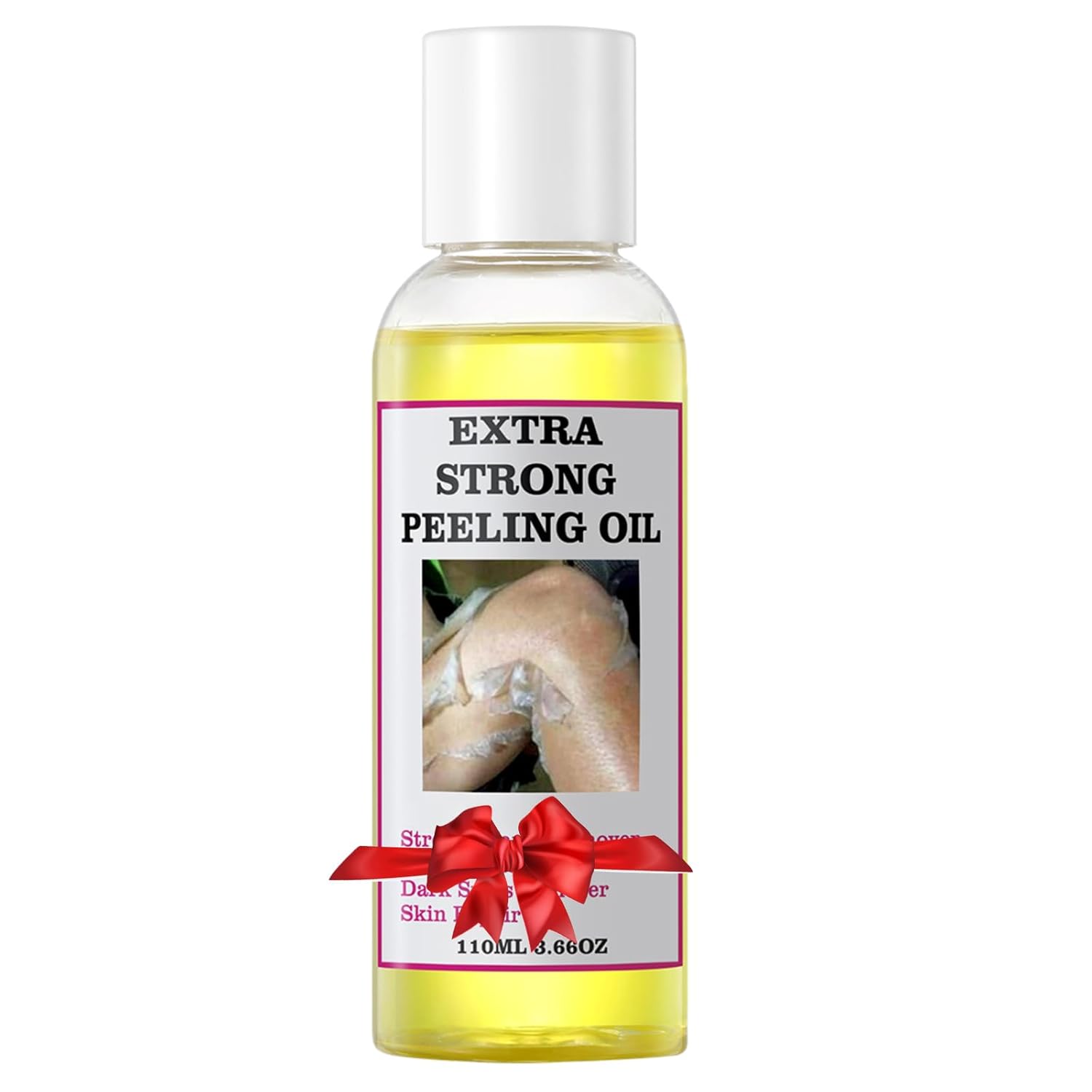Yellow Peeling Oil for Dark Skin Strong Peel Oil Extra Strength Exfoliating Chemical Exfoliant Peels Solution at Home Body peeling for Exfoliate Body Hand Foot Dark Knuckle All Skin Type 3.66 OZ