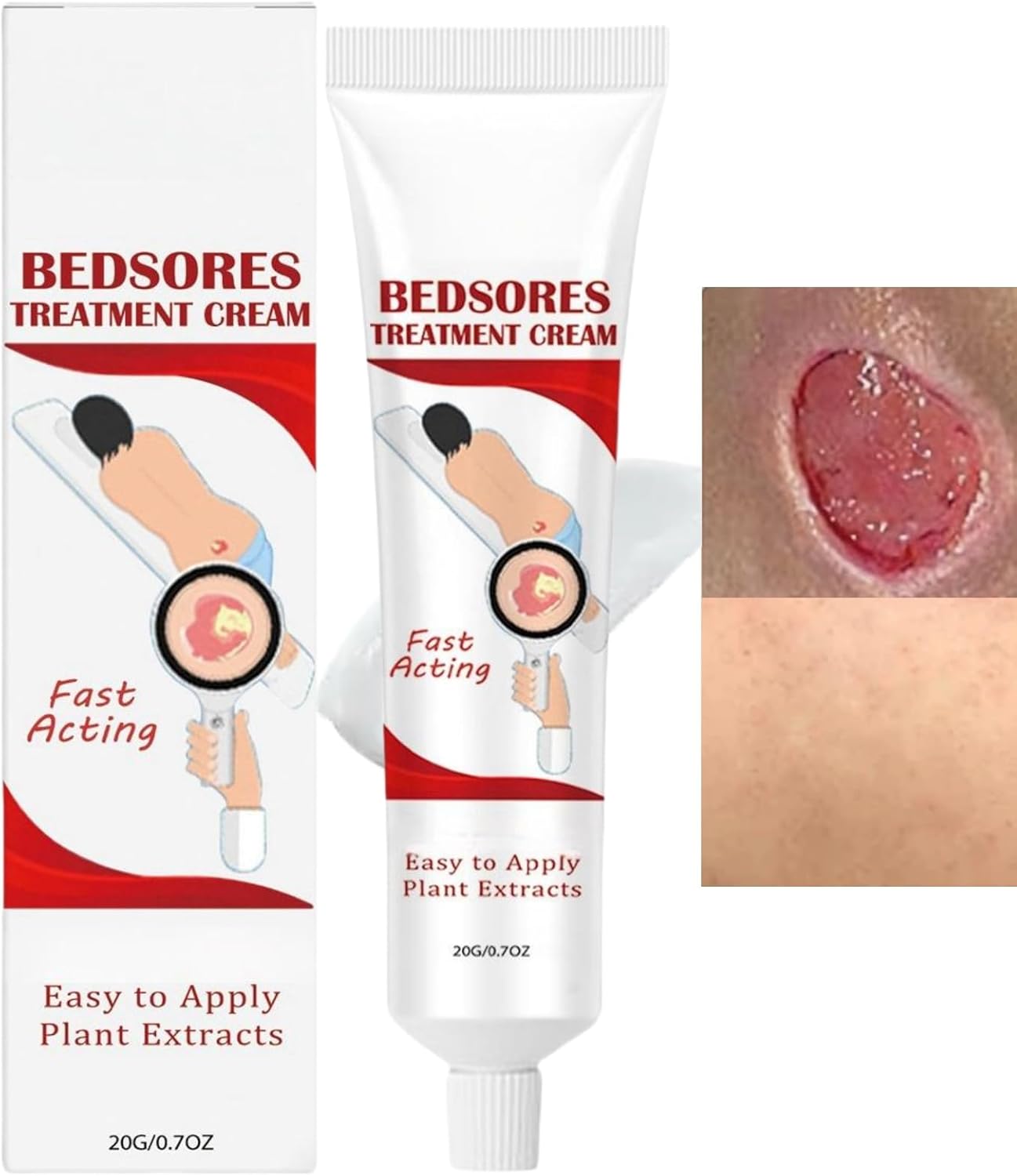 Bed Sore Cream,Bedsore Wound Care Cream,Pressure Sore Cream for Wound Care,Bed Sore Wound Treatment Cream,Pressure Sore Relief Cream,Soothing Relief Of Bed Soress,Quick and Effective Action Cream