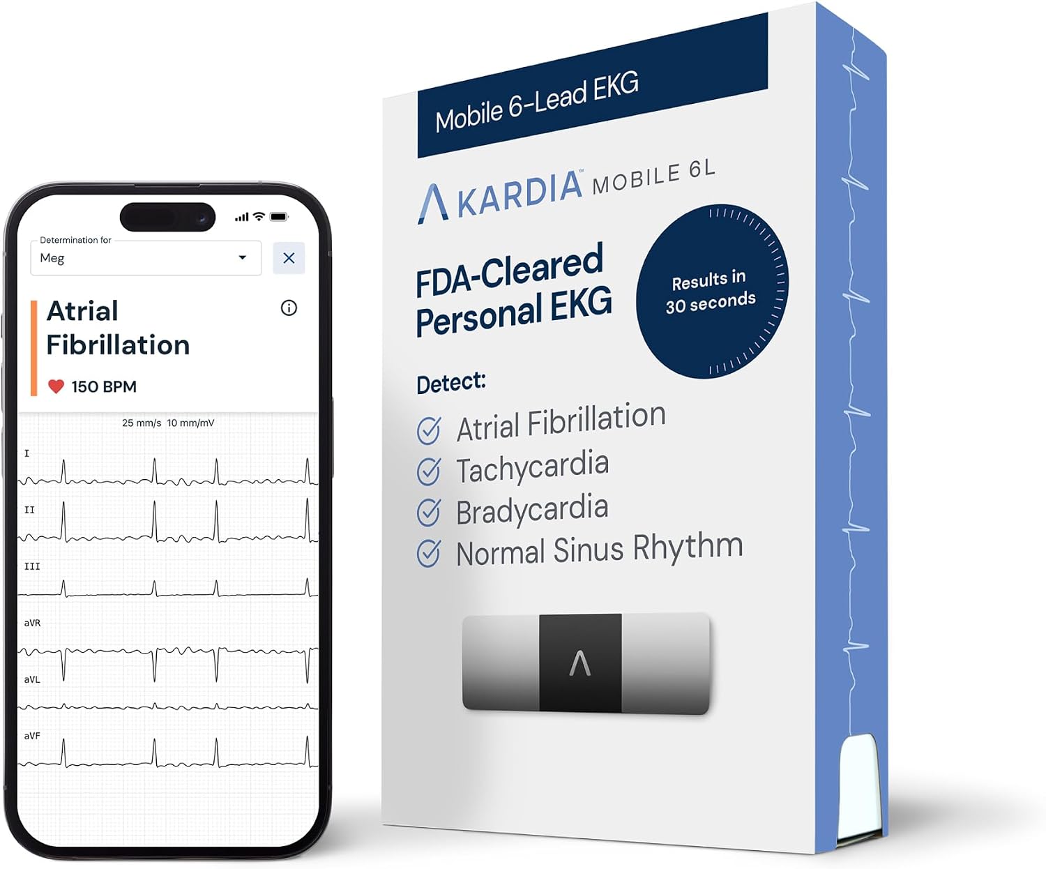 KardiaMobile 6-Lead Personal EKG Monitor – Six Views of The Heart – Detects AFib and Irregular Arrhythmias – Instant Results in 30 Seconds – Works with Most Smartphones - FSA/HSA Eligible