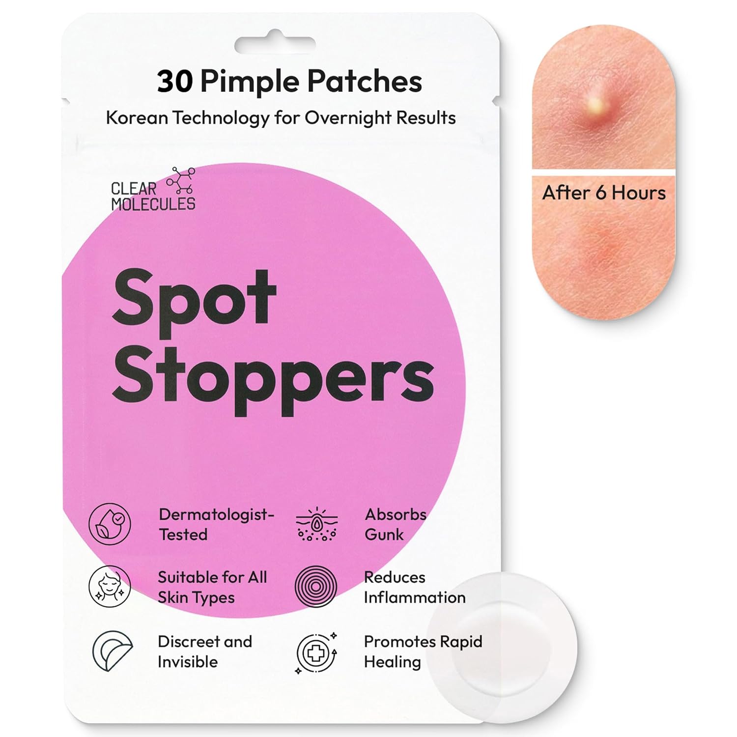 Spot Stoppers Pimple Patches - Invisible Spot Patches for Acne Treatment, Hydrocolloid Patches for Spot Treatment, Vegan & Cruelty Free Korean Skincare (30 Count (Pack of 1))