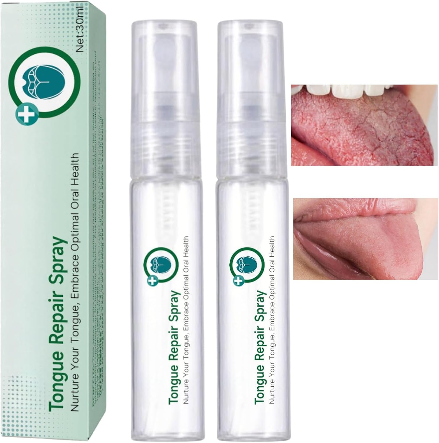 HIVETZ Tongue Repair Spray,2PCS Tongue Repair Spray for Dryness& Bad Breath,Fissured Tongue Relief Spray,Moisturising Dry Mouth Relief Spray,Instant Dry Mouth Relief,Breath Freshener Spray