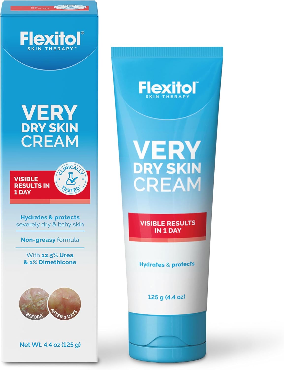 Flexitol Very Dry Skin Cream, Intensive Moisturizer for Severely Dry Skin, Urea-Based Hydration, 4 oz Tube