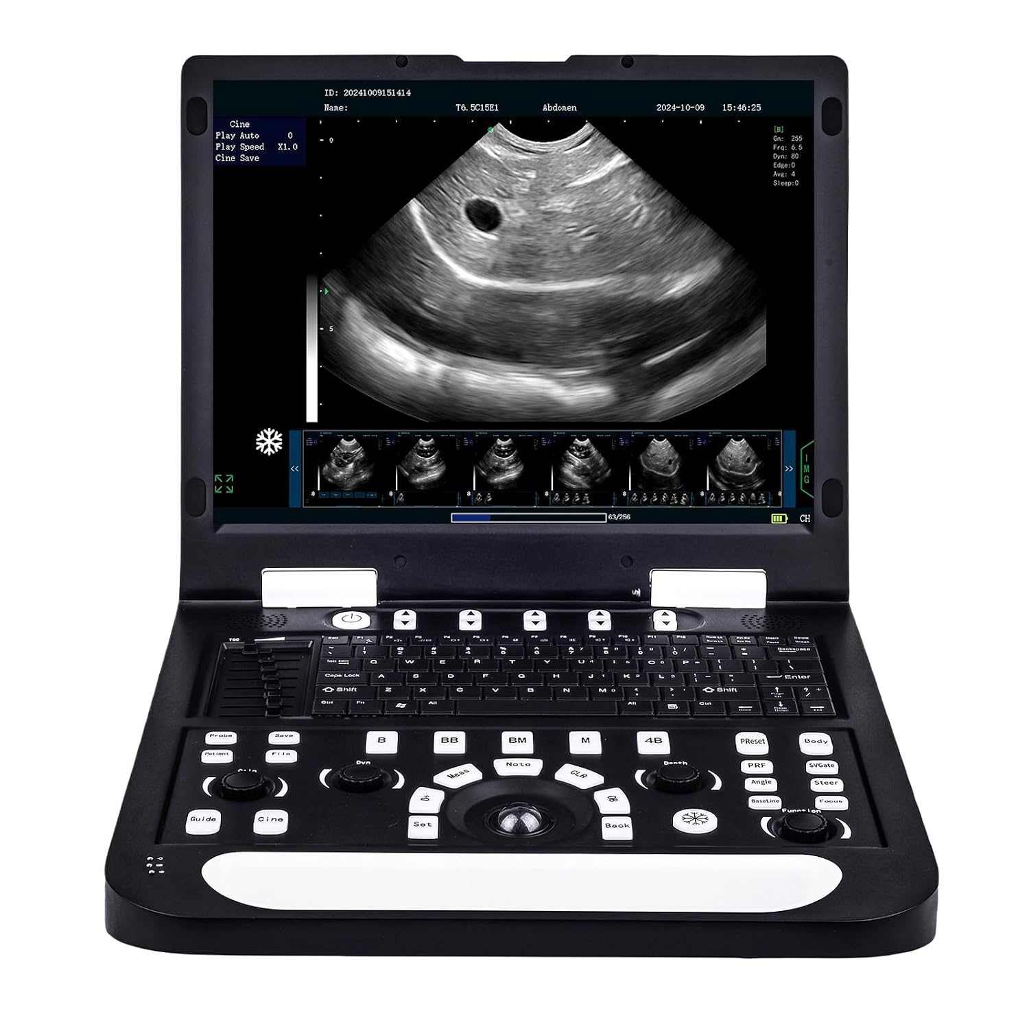 N60 Portable Veterinary Ultrasound Machine, PC-Based Ultrasound Systems, 15" High-Resolution LCD, for Dogs, Cats, and Small Animal Disease & Pregnancy Check (Micro-Convex Probe)