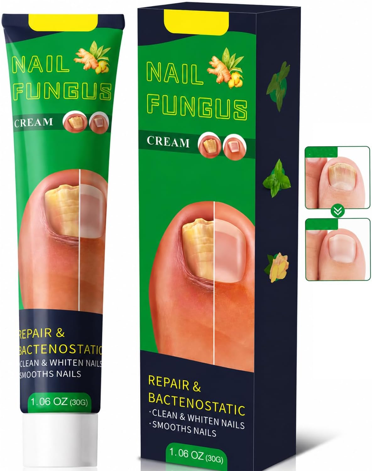 Fungal Nail Cream for Toenail and Finger — Fast-Absorbing Non-Greasy Nail Care Cream with Botanical Extracts — Suitable for Thick Rough and Discoloured Daily Care (28G)