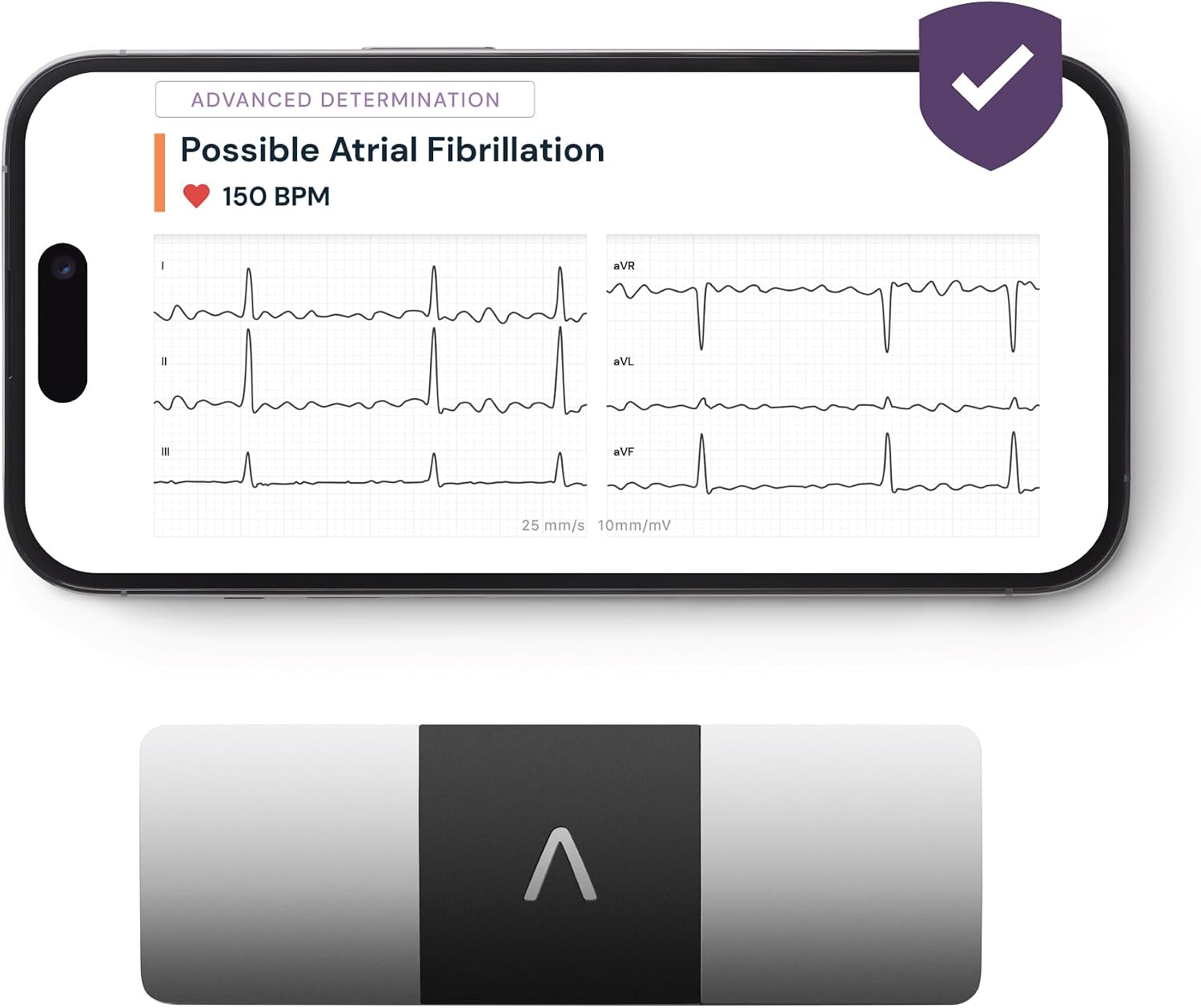 KardiaMobile 6-Lead ECG Heart Rate Monitor with 1-Month KardiaCare | Portable 6-lead ECG, easy to use, records medical-grade heart rhythm, includes 1-month KardiaCare membership, NHS Trusted