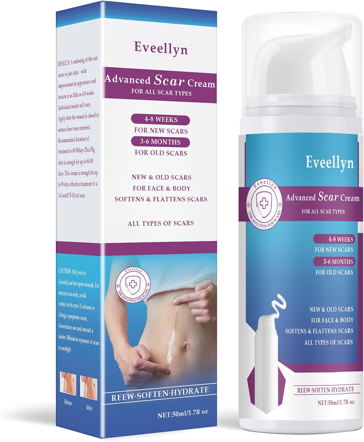 Eveellyn Scar Cream, Scar Gel, Professional Scar Removal Cream for Surgical Scars, Stretch Mark, Keloid Bump, C-Section, Burn, Acne, Old and New Scars 1.7 oz (50g), White