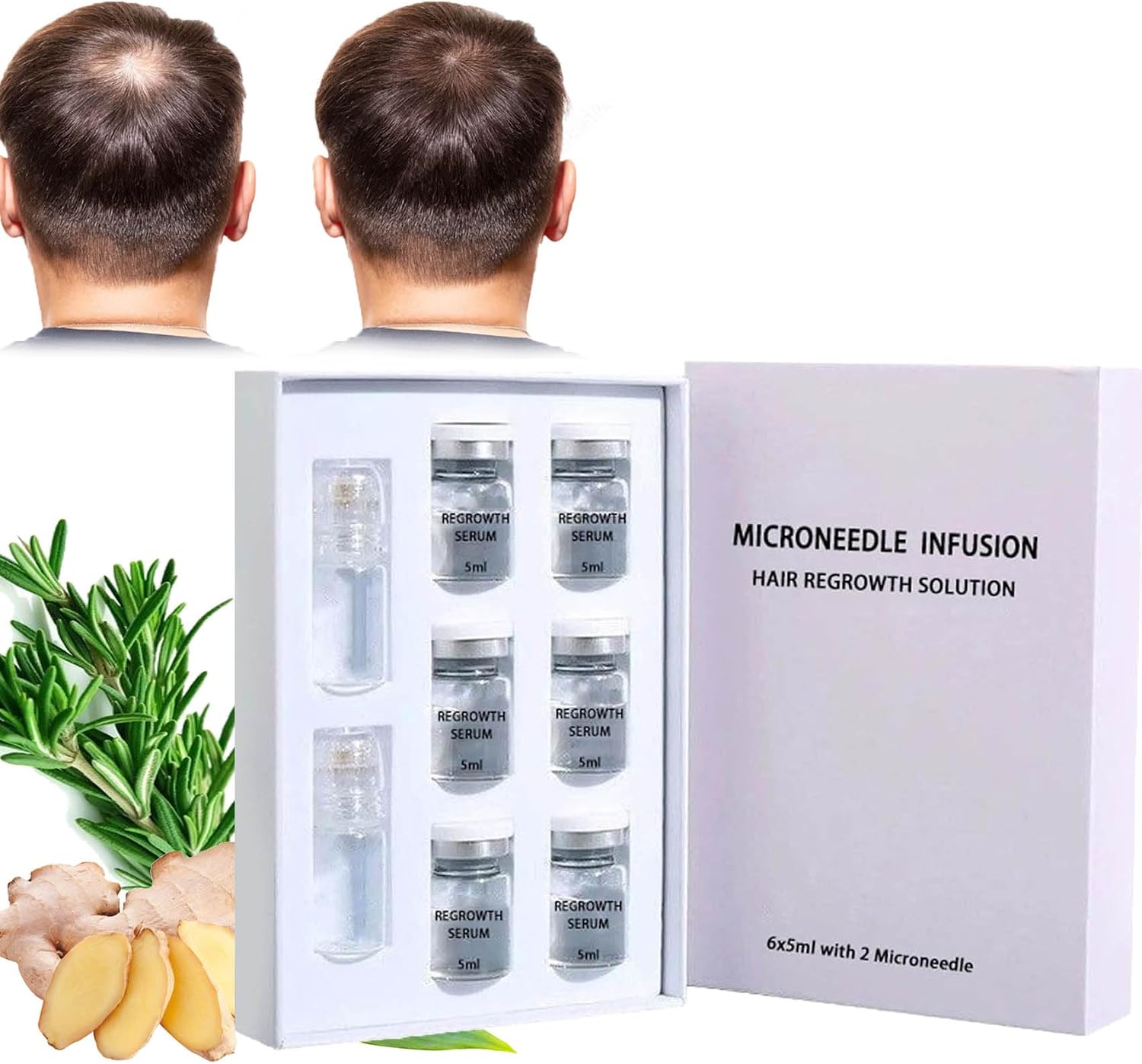 Alphainfuse Hair Regrowth System, Alphainfuse Hair Regrowth Treatment Serum, Painless Microneedle Infusion Hairregrowth Solution, 100% Natural Hair Oil With Rosemary Oil, For Hair Loss Thinning (6pc)